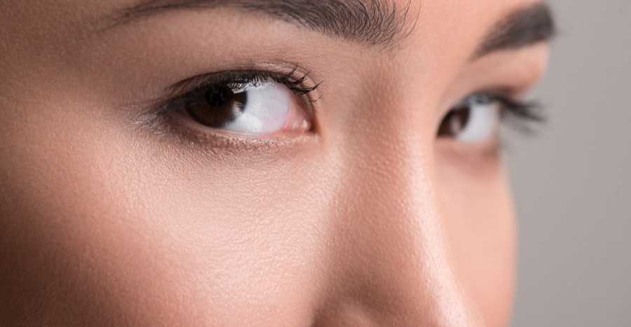 get a younger look with an eyelid lift in beverly hills 629796e02c5eb