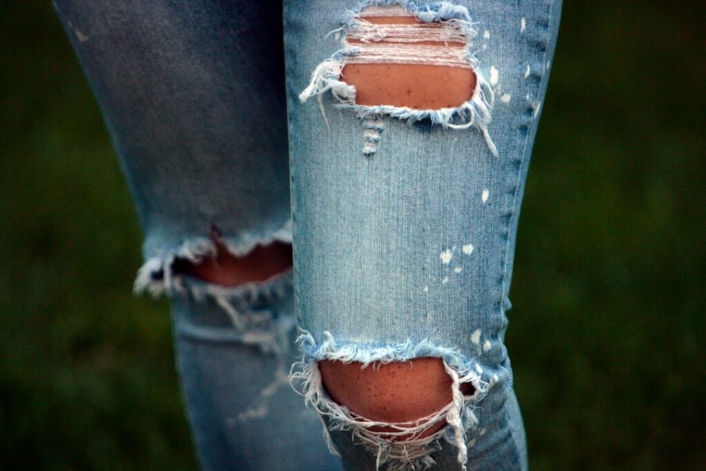 liposuction before and after thighs