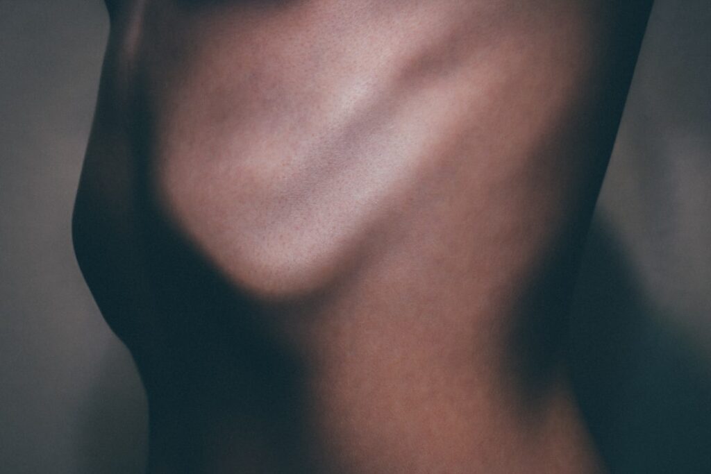 Awake Breast Lift