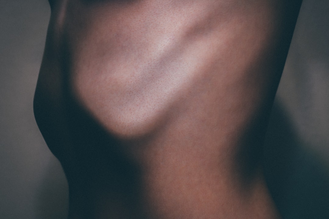 Awake Breast Lift