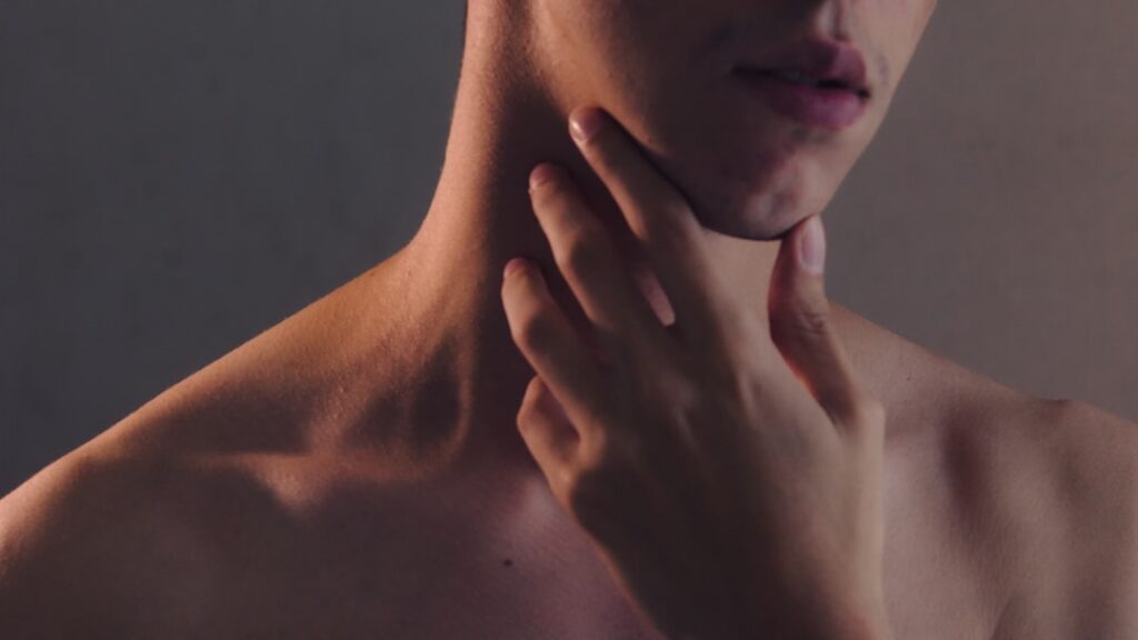 radiesse neck lines