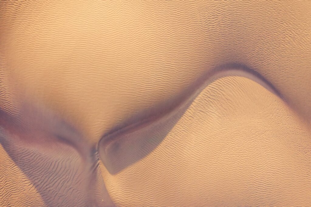 restylane cheek filler