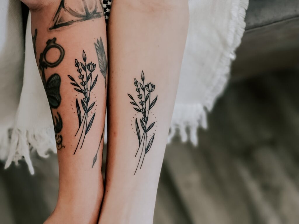 tattoo removal before and after pictures