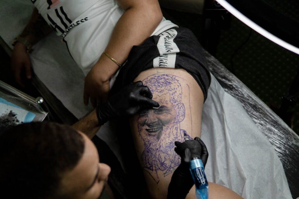 Tattoo removal Santa Monica