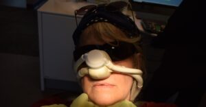 big nose operation