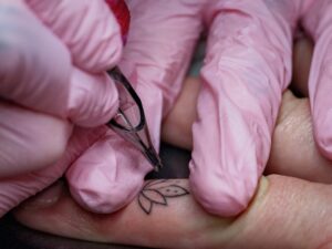 Latest tattoo removal technology