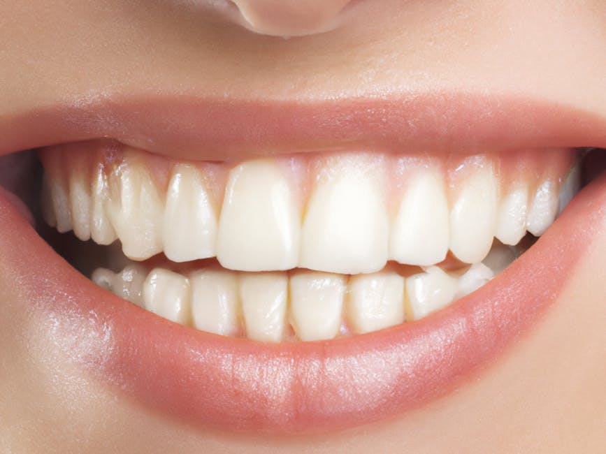lip augmentation before after