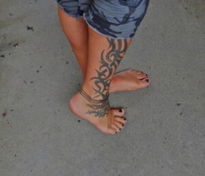 Tattoo removal near me