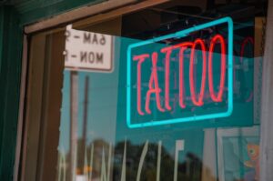 Tattoo removal West Hollywood