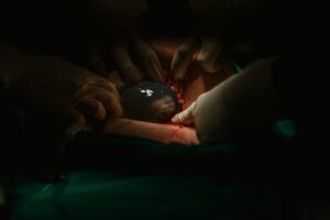 awake during surgery