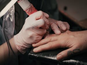Local anesthetic tattoo removal