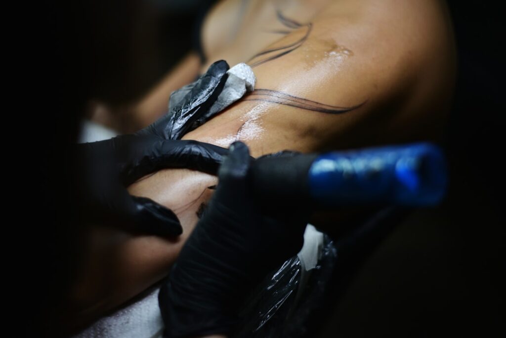 Safe laser tattoo removal