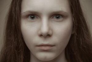 Brow lift non-surgical