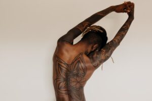 Tattoo removal for dark skin