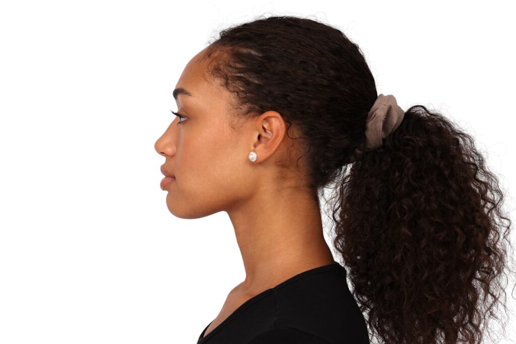Neck hump fat removal