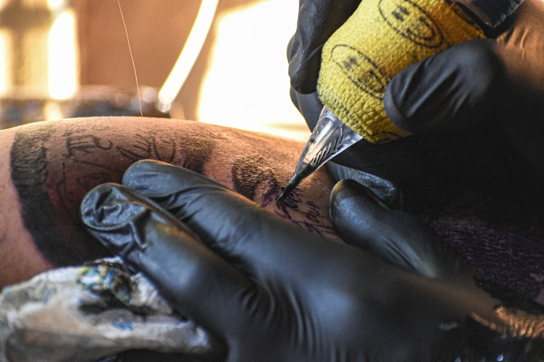 removal of unwanted tattoos