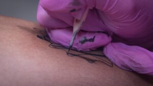 painless tattoo removal cost
