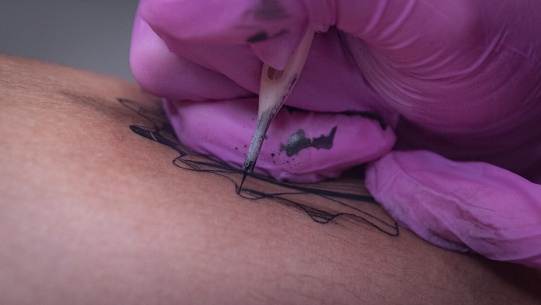 painless tattoo removal cost