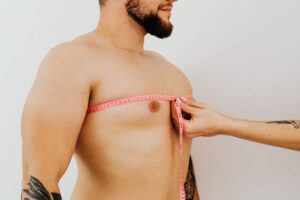 Male chest liposuction