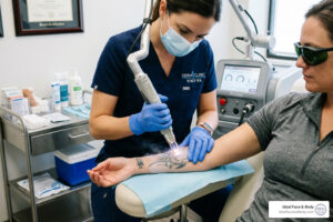 laser tattoo removal prices