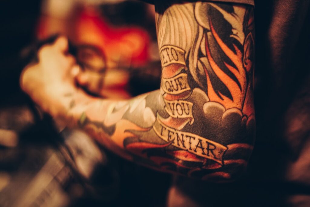 laser tattoo removal affordable price
