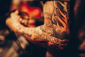 laser tattoo removal affordable price