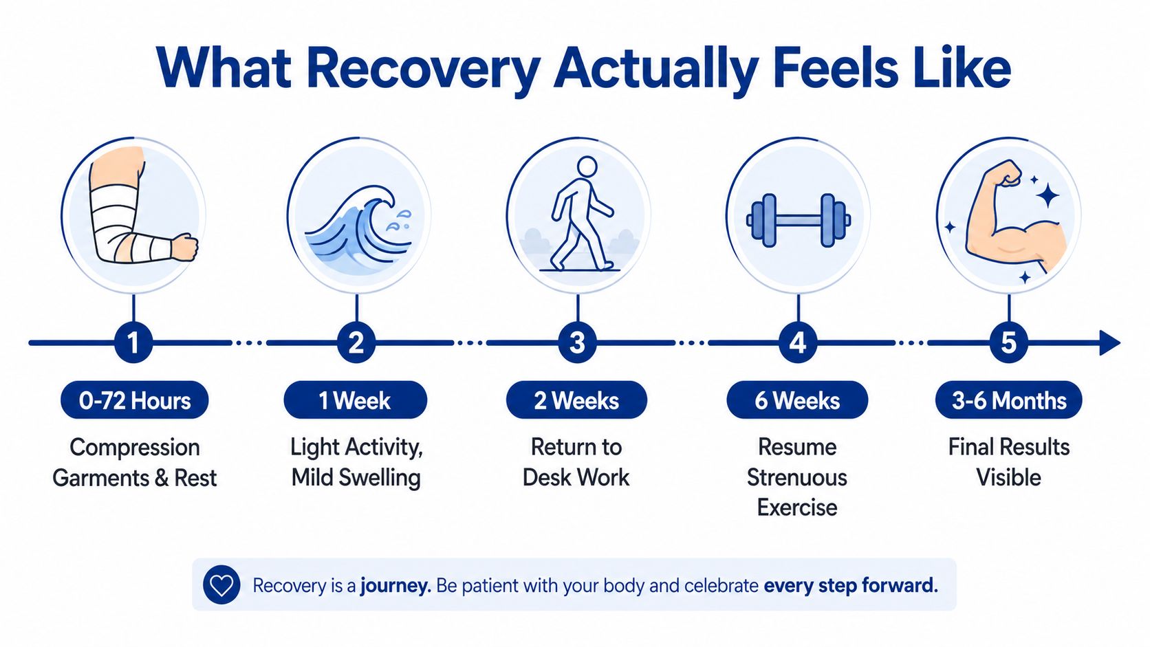 A recovery timeline chart for surgical procedures showing five stages from compression garments to final results.