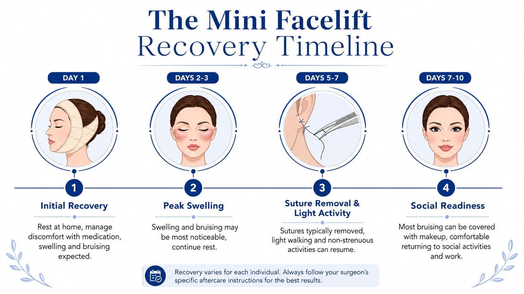 An infographic showing the four stages of mini facelift recovery, from initial bandaging to social readiness.
