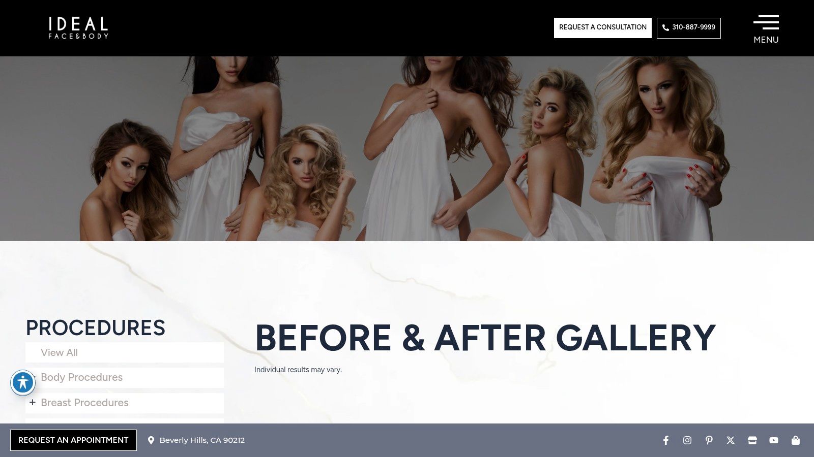 Screenshot from https://idealfaceandbody.com/gallery/