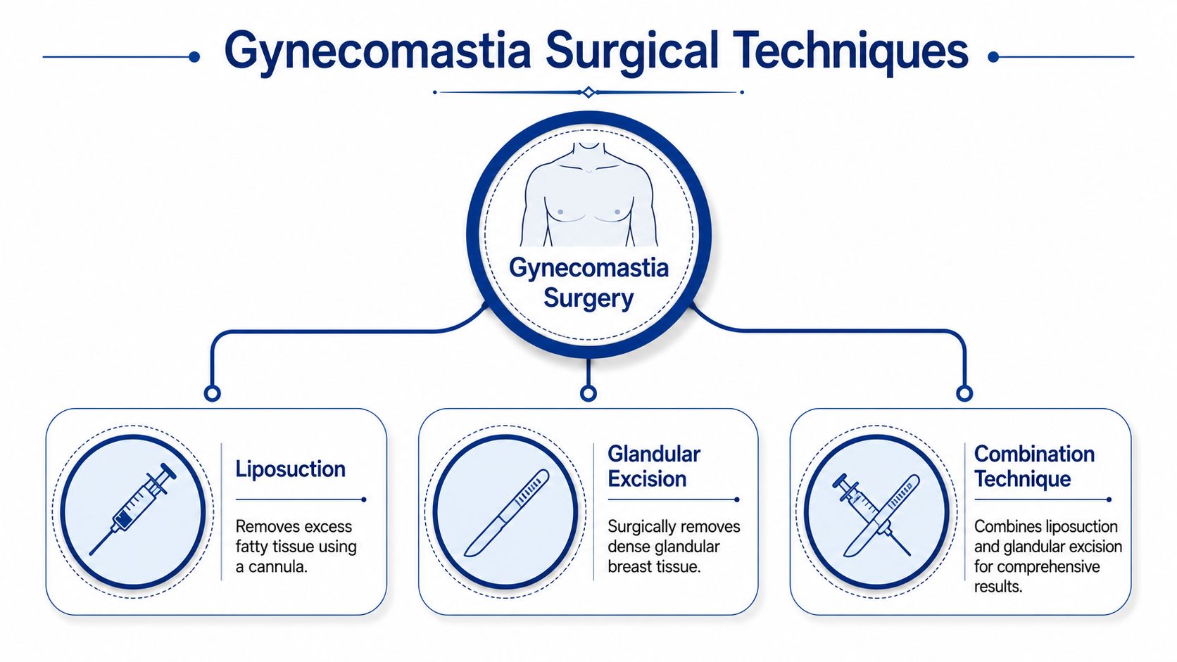 A diagram outlining the three main surgical techniques for treating gynecomastia: liposuction, glandular excision, and combined approach.