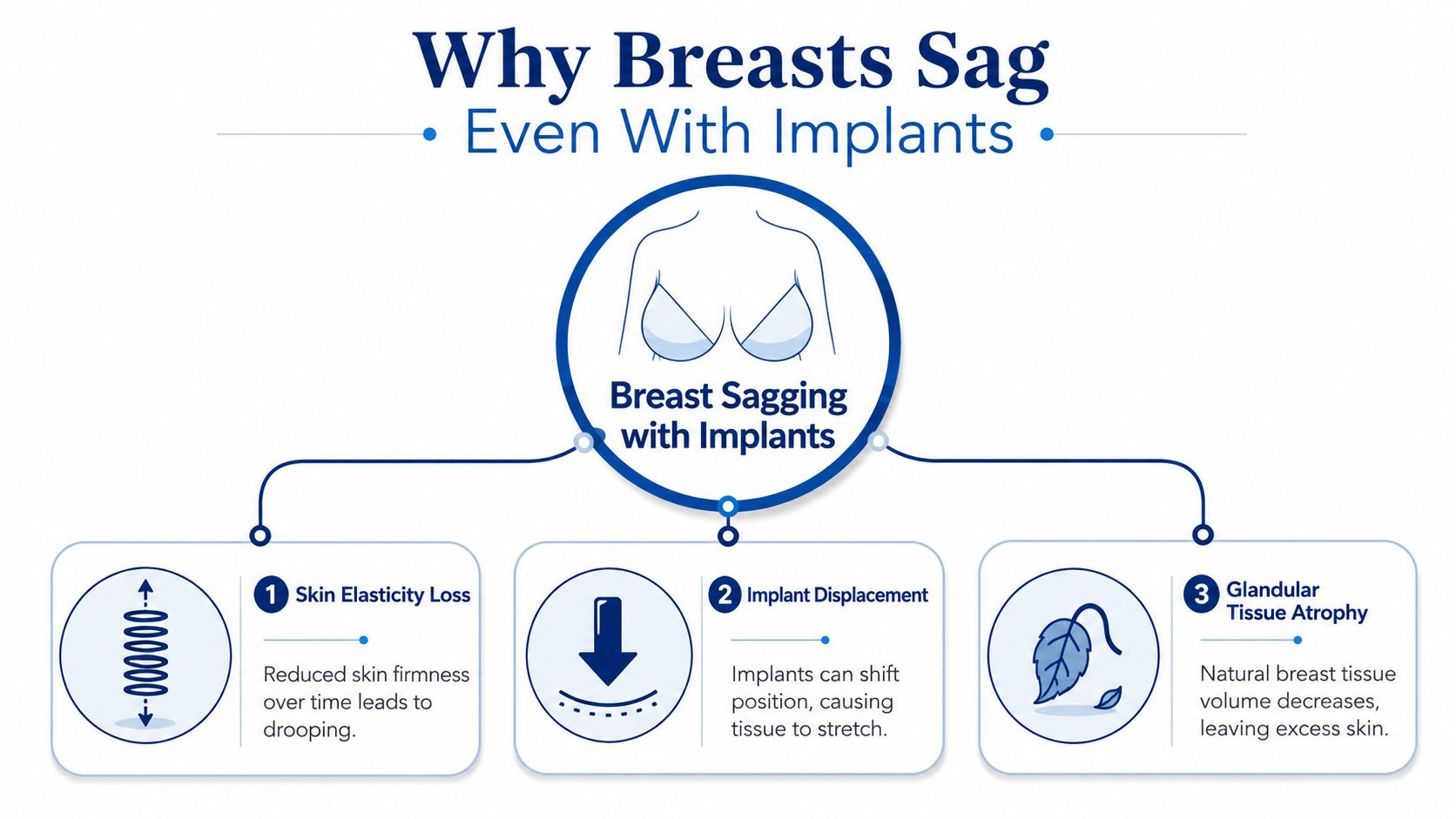 An infographic titled Why Breasts Sag Even With Implants, explaining causes like skin elasticity loss, implant displacement, and atrophy.