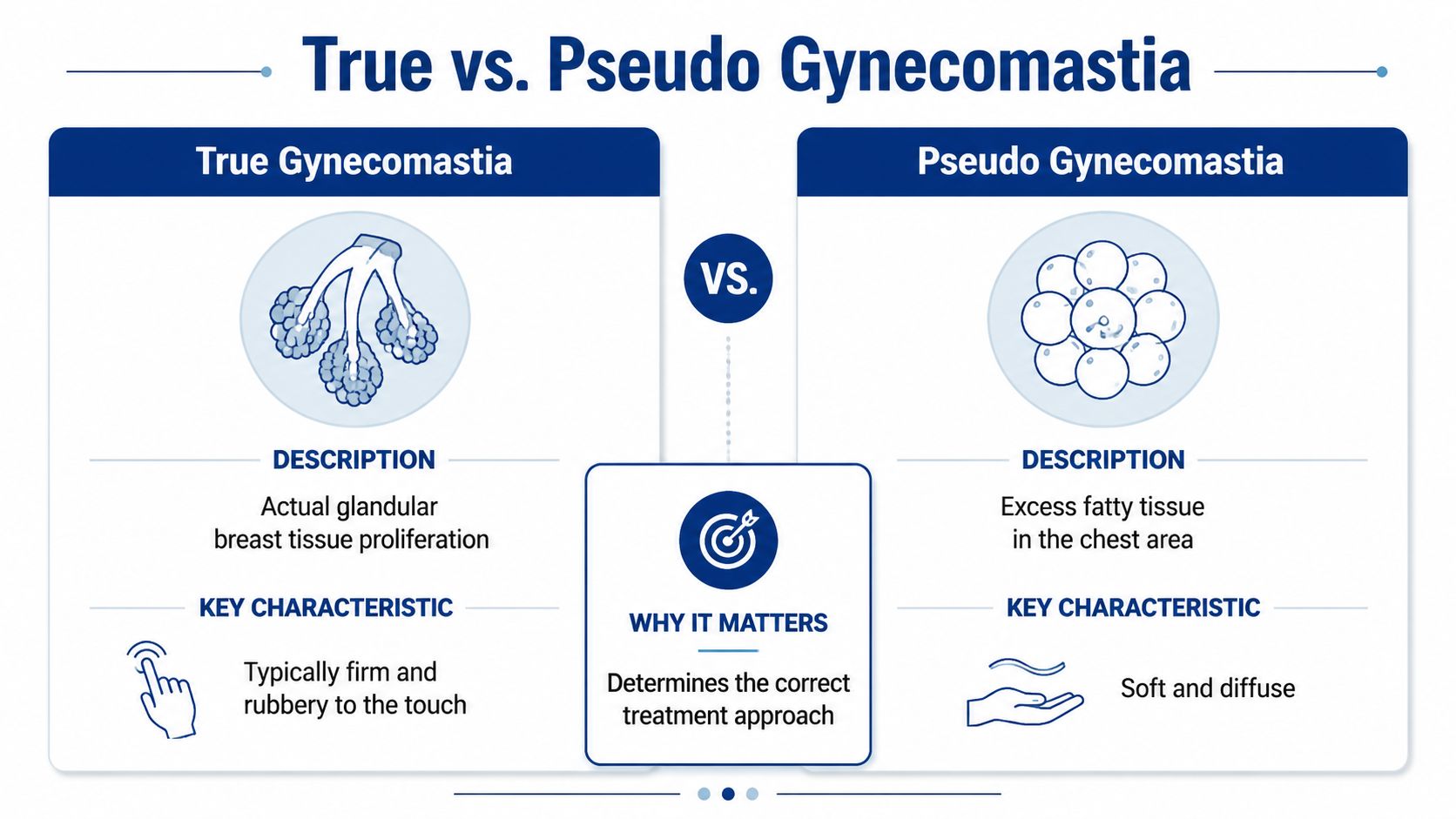 A comparison infographic explaining the differences between true gynecomastia and pseudo gynecomastia using medical illustrations.