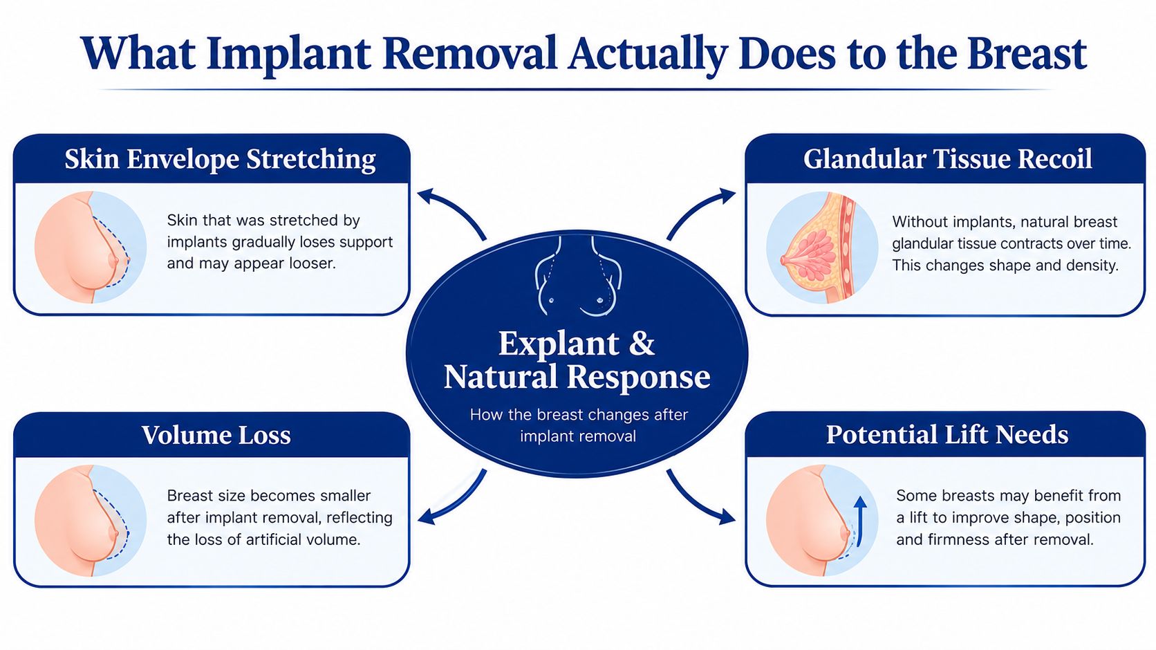 An infographic showing four key physiological changes in the breast after breast implant removal surgery.