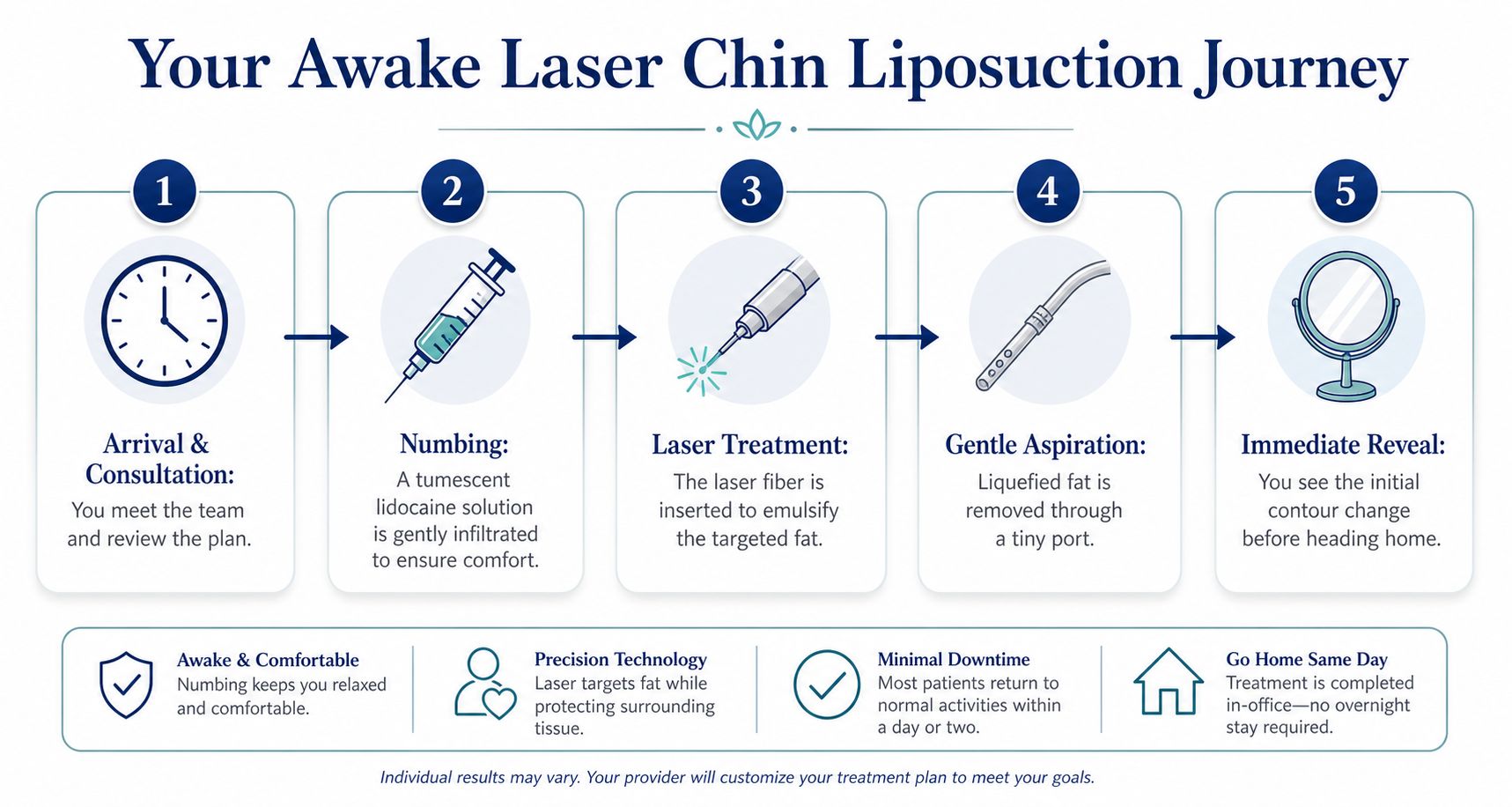 A step-by-step infographic illustrating the five stages of an awake laser chin liposuction procedure.