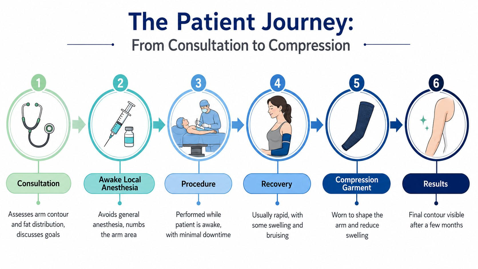 A six-step infographic illustrating the upper arm liposuction patient journey from consultation through to final results.
