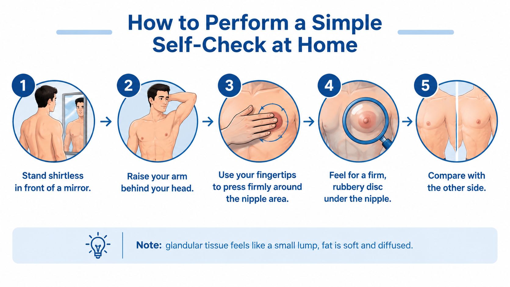 An infographic illustrating five steps for men to perform a breast self-check at home for potential gynecomastia.
