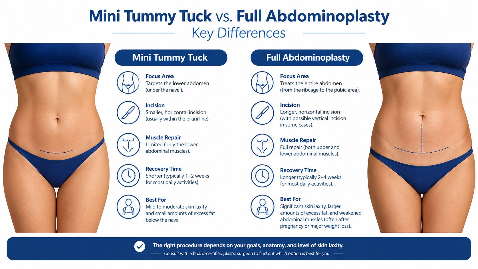 A comparison infographic showing the differences between a mini tummy tuck and a full abdominoplasty surgical procedure.