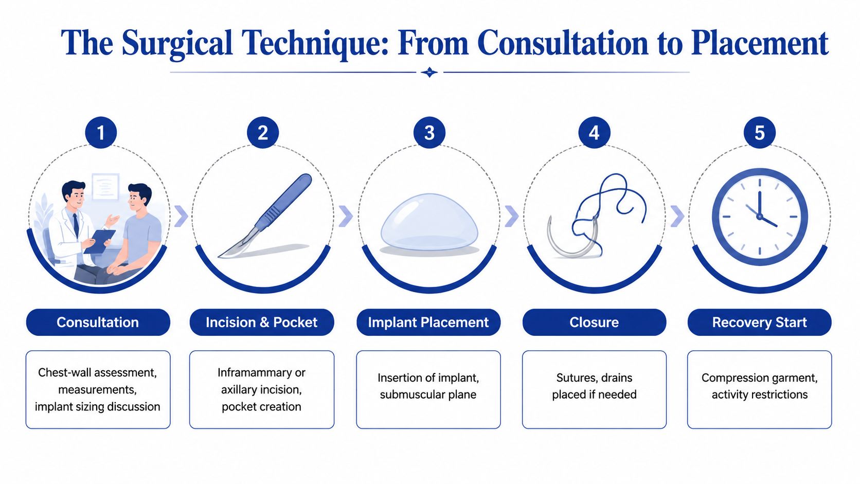A step-by-step infographic illustrating the surgical process for male pectoral implant procedures from consultation to recovery.