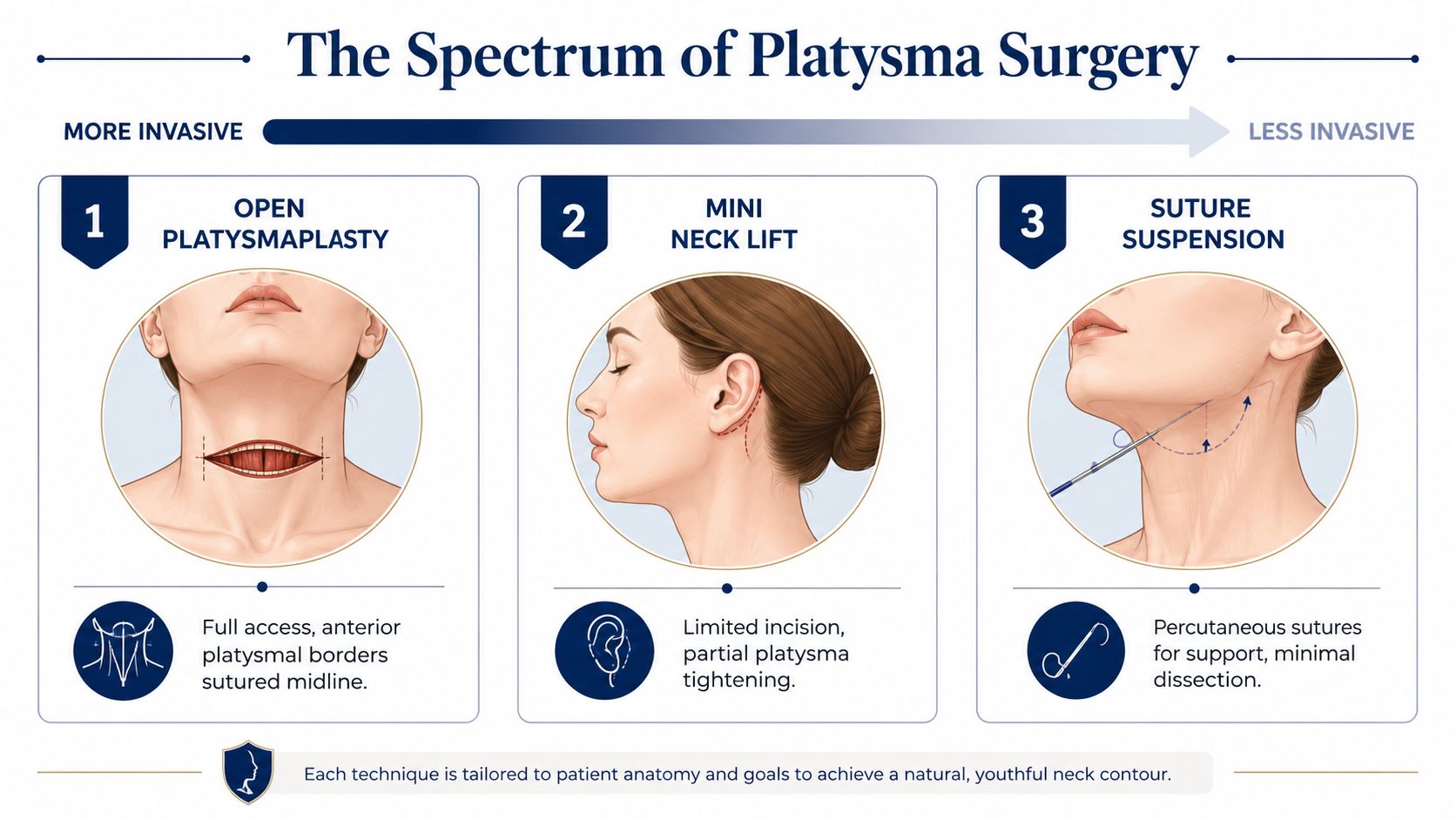 An infographic illustrating three types of platysma surgery, ranging from open platysmaplasty to suture suspension techniques.
