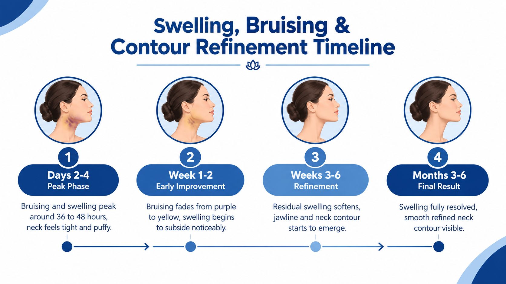 A timeline graphic showing the stages of neck swelling and bruising recovery after a cosmetic procedure.