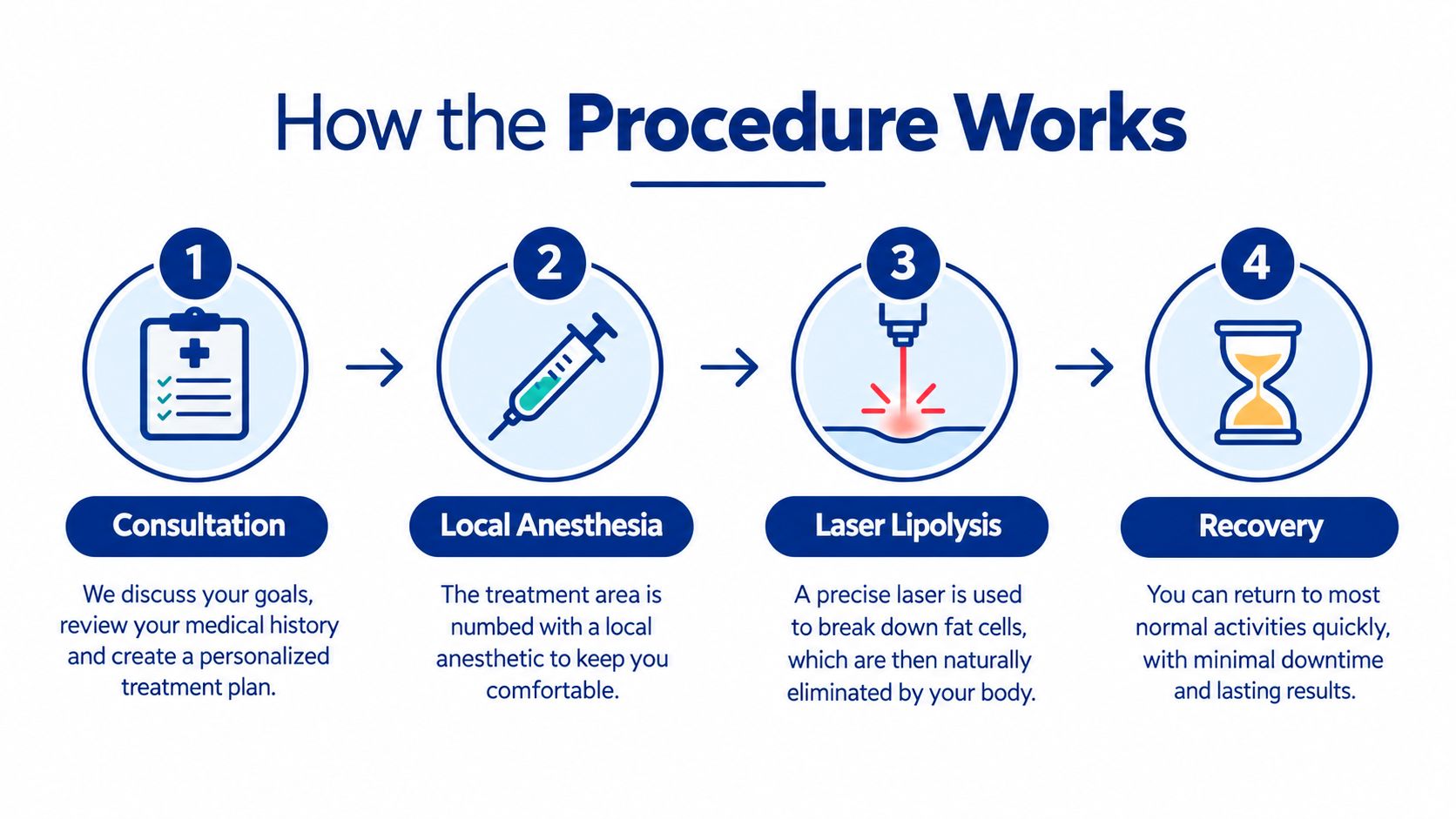 An infographic showing the four-step process for laser liposuction, including consultation, local anesthesia, laser lipolysis, and recovery.