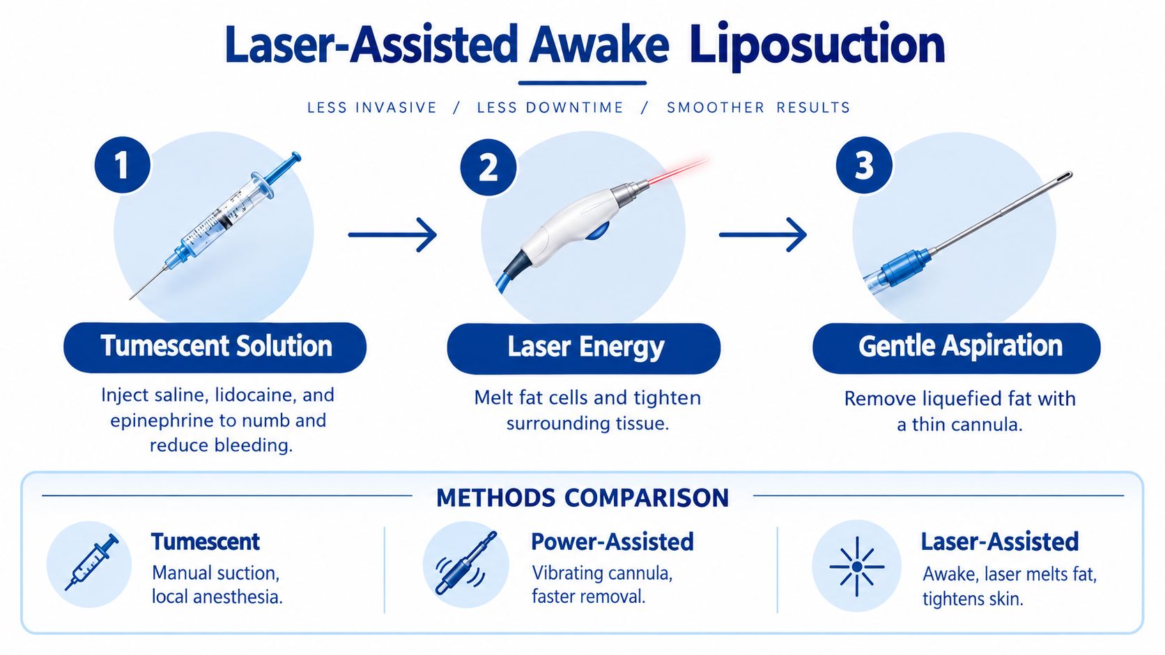 A three-step infographic explaining the process of laser-assisted awake liposuction and comparing different lipo methods.